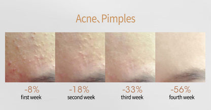 Acne Removing Salicylate Products